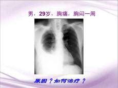 胸腔积液课件