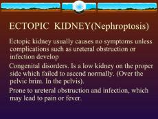ECTOPIC  KIDNEY(Nephroptosis)异位肾