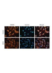 LX2 cell SAHA treatment