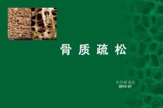 骨质疏松课件