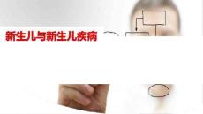 新生儿与新生儿疾病 ppt课件