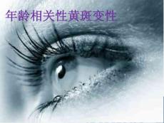 年龄相关性黄斑变性