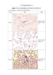 2016年第1次血細胞形態學檢查室間質量評價