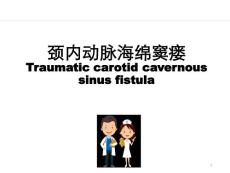 颈内动脉海绵窦瘘ppt参考课件