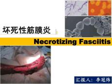 坏死性筋膜炎necrotizingfasciitis