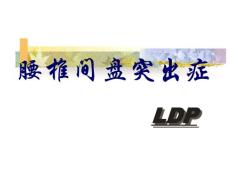 腰椎间盘突出症