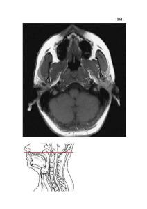 头颈部CT与MRI断层解剖图谱-颈部