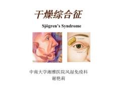 干燥综合征