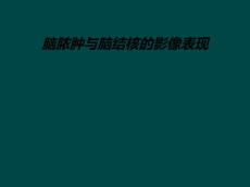 脑脓肿与脑结核的影像表现