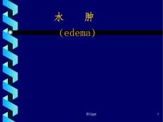 202x年医学专题—水肿edema概述一水肿的定义水肿过多的体液在