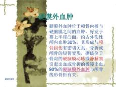 硬脑膜外血肿
