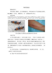 隐翅虫的预防