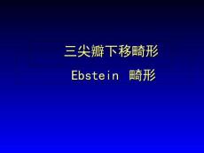 三尖瓣下移畸形ppt课件