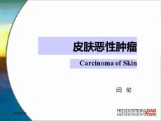 体表三大恶性肿瘤概述123