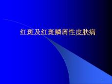 红斑及红斑鳞性皮肤病红斑