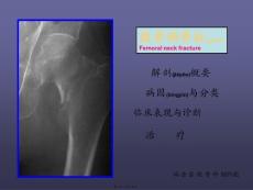 股骨颈骨折-课件