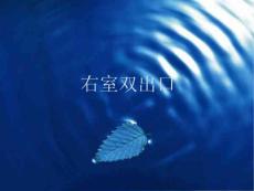 右室双出口的影像表现