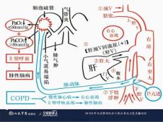 慢性心衰治疗