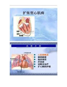 扩张型心肌病查房