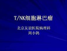 t-nk细胞淋巴瘤幻灯片