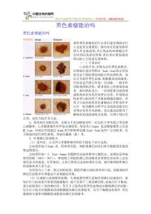 黑色素瘤能治嗎