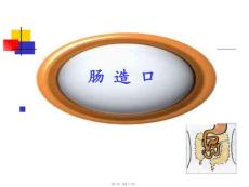 肠造瘘术