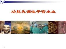 异常子宫出血功能失调性子宫出血PPT课件
