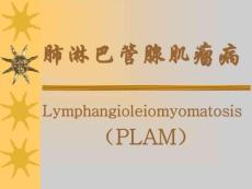 肺淋巴管腺肌瘤病