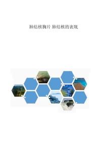 肺结核胸片肺结核的表现