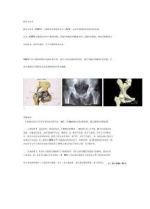 股骨头坏死介绍