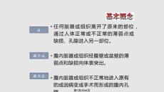腹外疝学习教程
