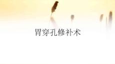胃穿孔修补术