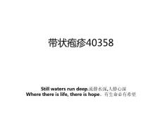 带状疱疹40358