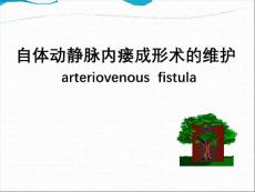 动静脉内瘘