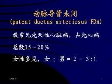动脉导管未闭ppt课件