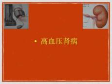 《高血压肾病》PPT课件