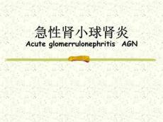 急性肾小球肾炎