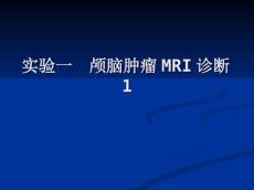 颅脑肿瘤mri