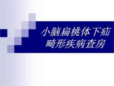 小脑扁桃体下疝畸形ppt课件