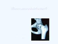 股骨颈骨折Howcanwedoitbetter