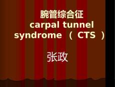 血液透析腕管综合征