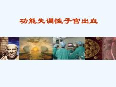 异常子宫出血功能失调性子宫出血