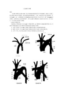 主动脉弓中断