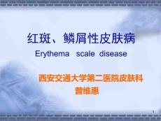 红斑、鳞屑性皮肤病西安交通大学第二医院皮肤科曾维惠