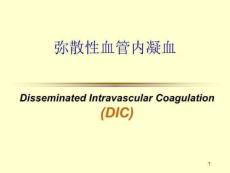 dic弥散性血管内凝血
