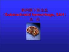 蛛网膜下腔出血新