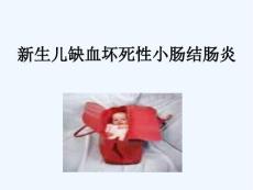 新生儿缺血坏死性小肠结肠炎