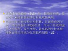 红斑狼疮细胞检查