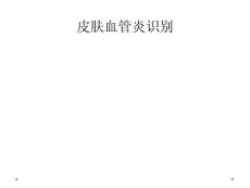 皮肤血管炎识别