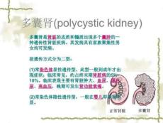 《多囊肾的护理》PPT课件